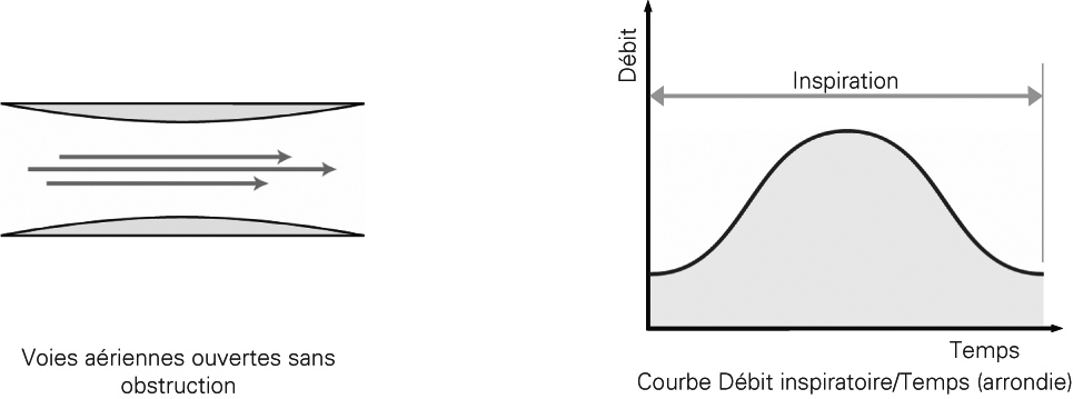 SL Diagram Normal airway