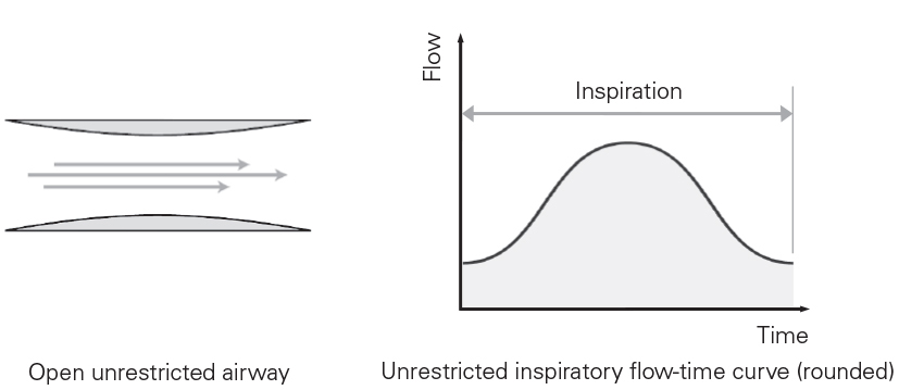SL Diagram Normal airway