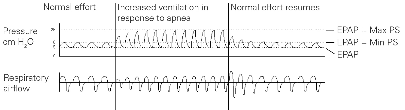 SL Diagram Pressure Support