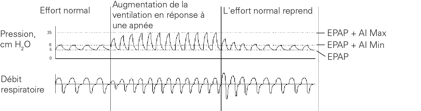 ET_Pressure_Support.eps