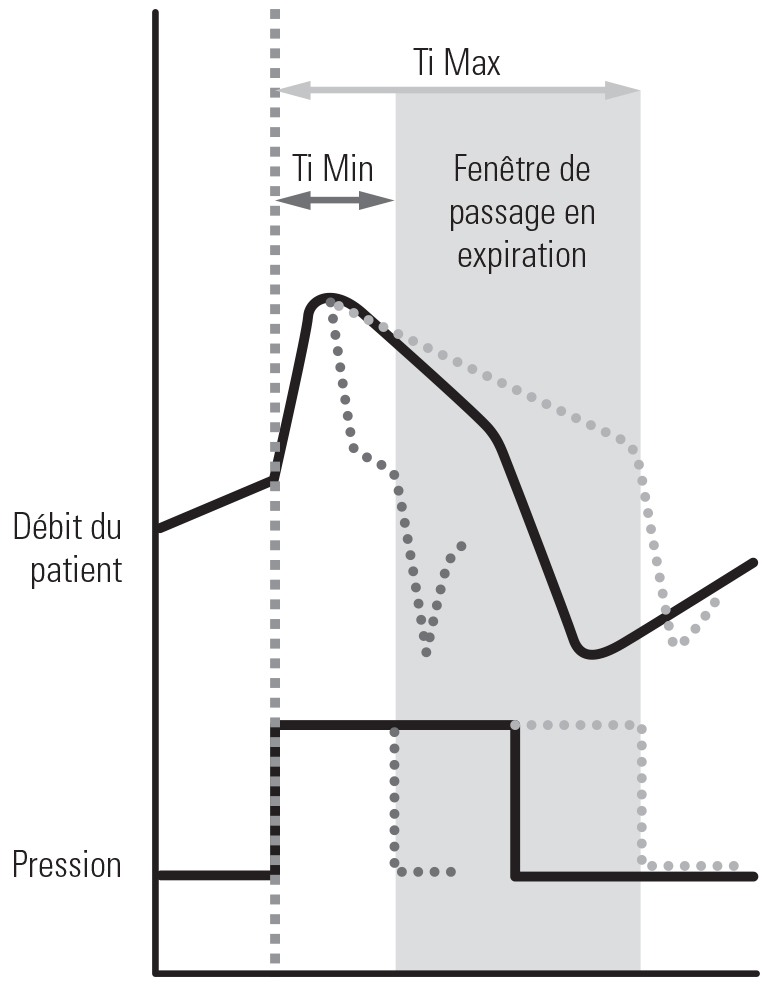 SL Diagram TiControl - Inspiratory time control
