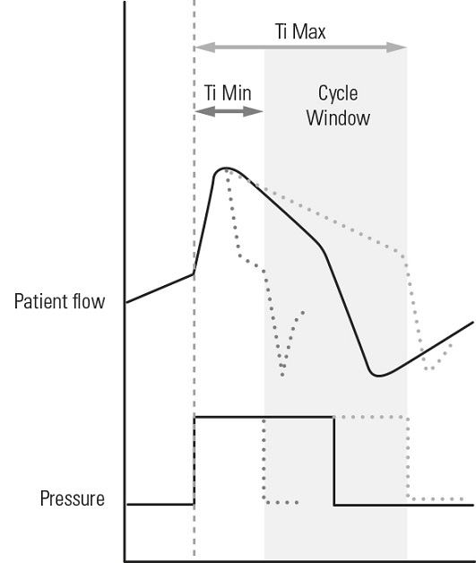 SL Diagram TiControl - Inspiratory time control