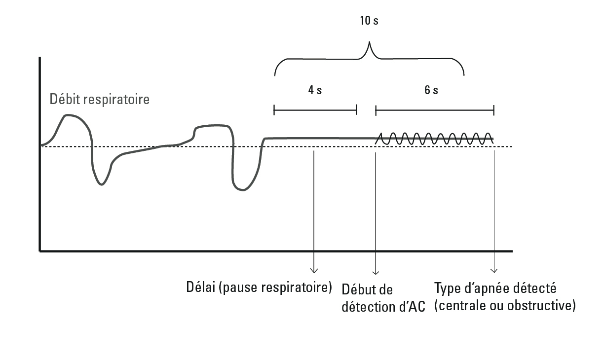 SL Diagram Central sleep apnea detection