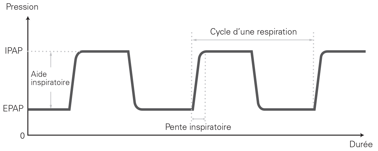 SL Diagram Bilevel pressures