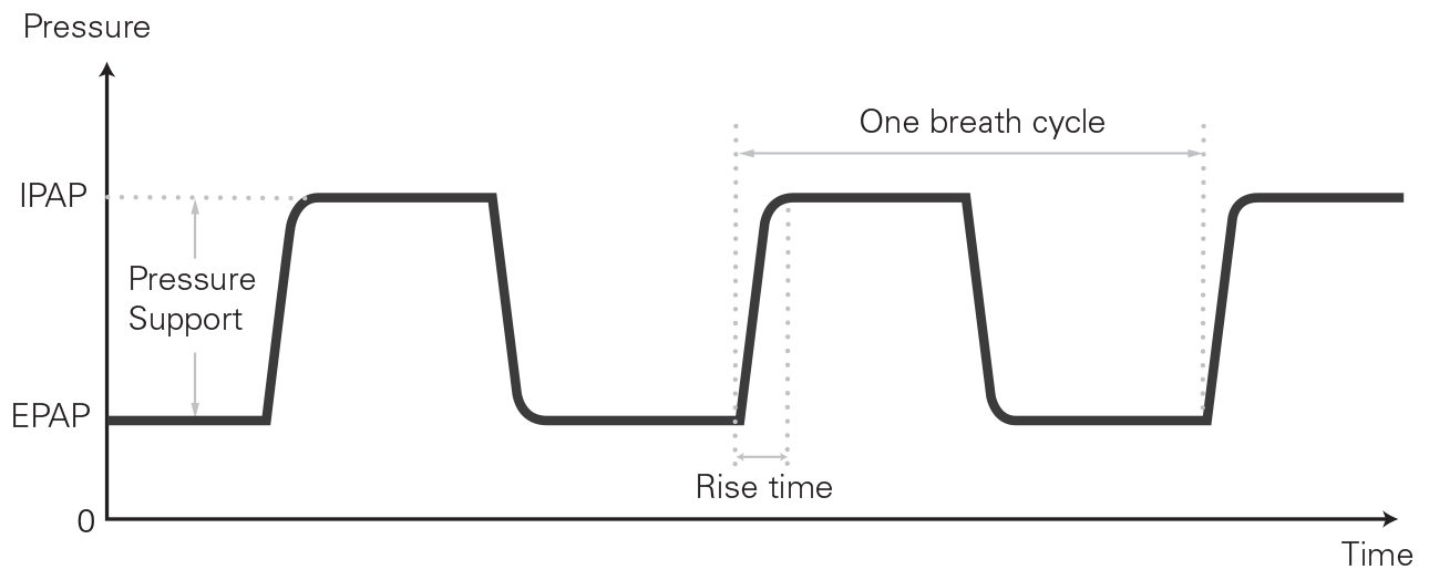 SL Diagram Bilevel pressures