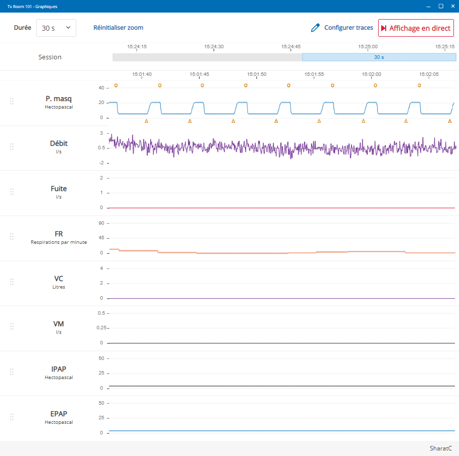 Live_graphs.png