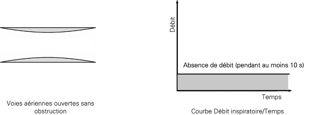 SL Diagram Central apnea