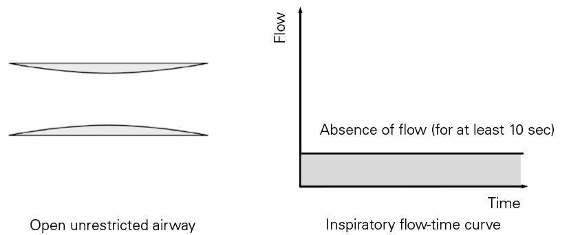 SL Diagram Central apnea